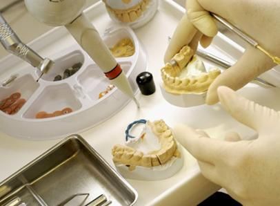 Laboratorio Dental Macías y Calvete moldes de dentadura
